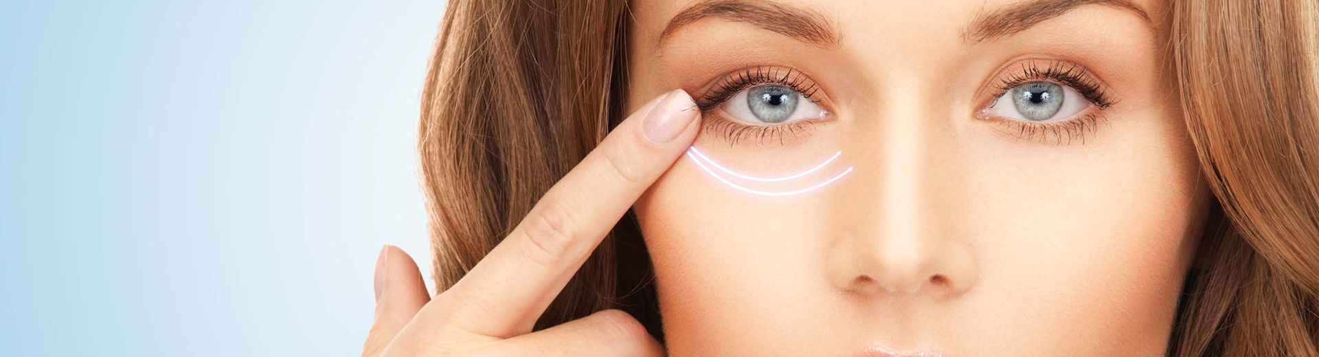 Верхняя блефаропластика – молодость ваших глаз